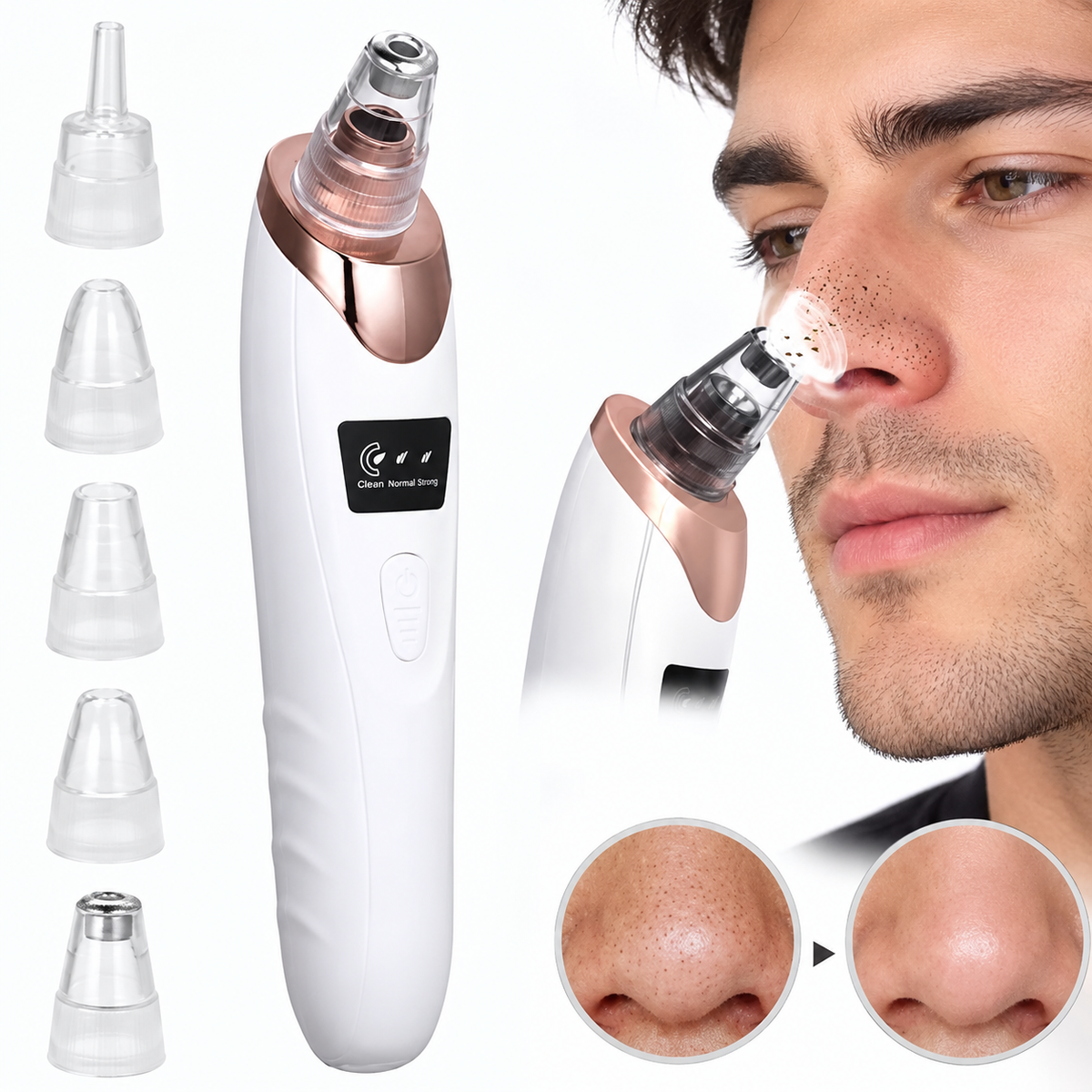 5 in 1 Blackhead Remover Machine Rechargeable | Face Vacuum Derma Suction With 5 Heads | Blackhead Removing Machine