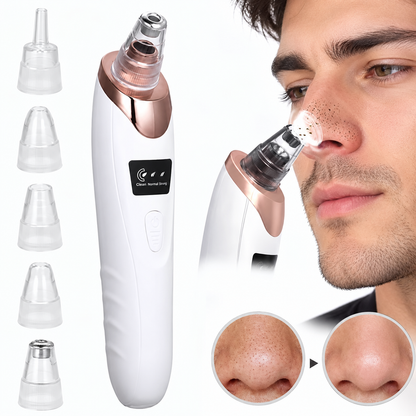 5 in 1 Blackhead Remover Machine Rechargeable | Face Vacuum Derma Suction With 5 Heads | Blackhead Removing Machine