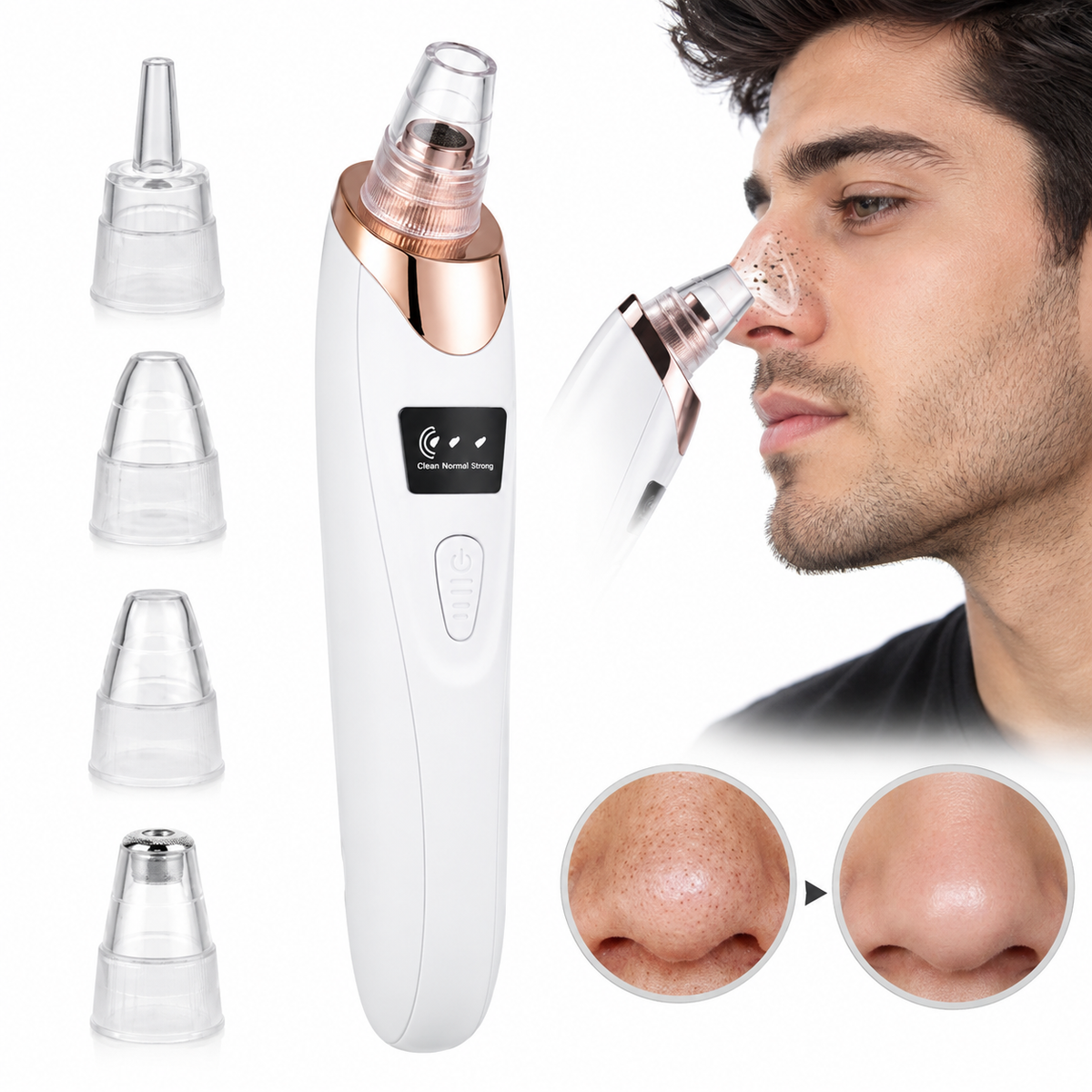 5 in 1 Blackhead Remover Machine Rechargeable | Face Vacuum Derma Suction With 5 Heads | Blackhead Removing Machine