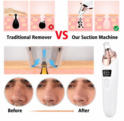 5 in 1 Blackhead Remover Machine Rechargeable | Face Vacuum Derma Suction With 5 Heads | Blackhead Removing Machine